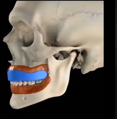 Why  This Solves Most TMJ Issues